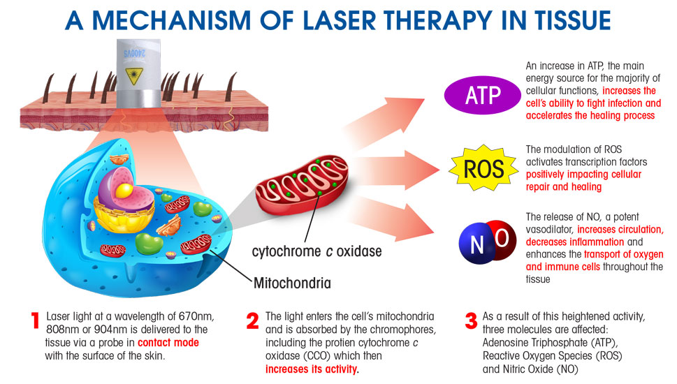 laser_diagram